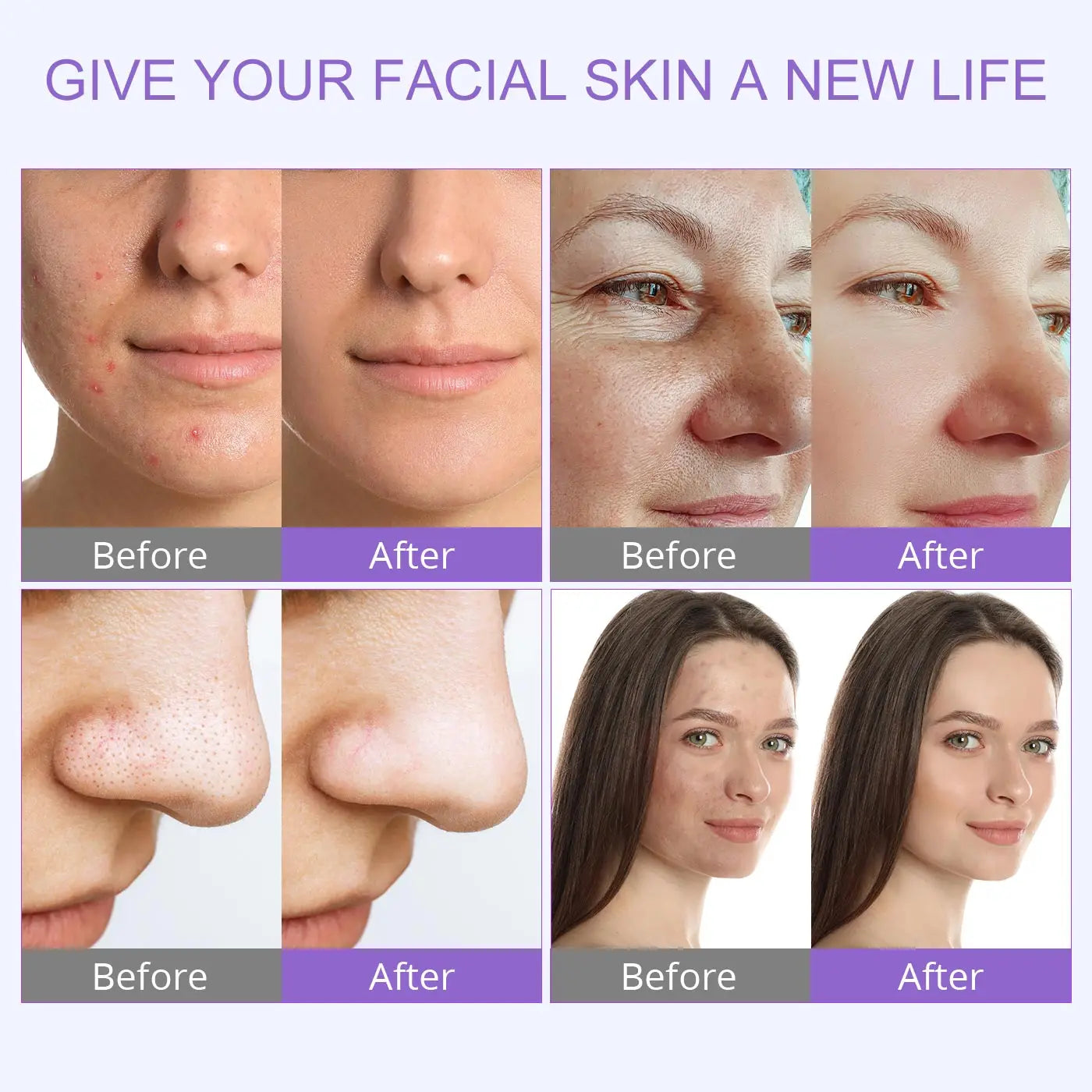 Professional Hydro Water Oxygen Machine Jet Peel Oxy Spray Facial Machine Face Cleaning Lifting Dermabrasion Skin Care Beauty